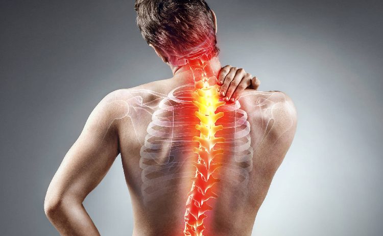 Terapi Saraf Kejepit di Leher Tanpa Operasi di Klaten, Solusi Aman di Panti Sehat Nawasena Klaten